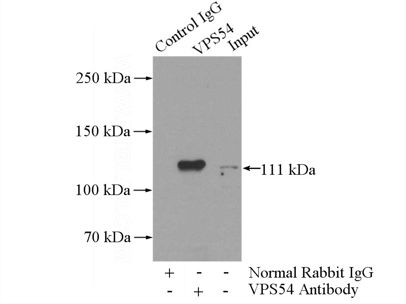 IP Result of anti-VPS54 (IP:Catalog No:116795, 4ug; Detection:Catalog No:116795 1:300) with mouse brain tissue lysate 4000ug.