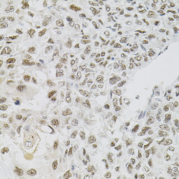 Immunohistochemistry - FAF1 Polyclonal Antibody 