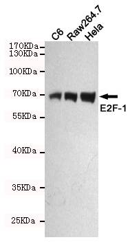 Western blot detection of E2F-1 in C6,Raw264.7 and Hela cell lysates using E2F-1 mouse mAb (1:500 diluted).Predicted band size:70KDa.Observed band size:70KDa.