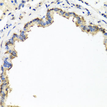 Immunohistochemistry - CXCR4 Polyclonal Antibody 