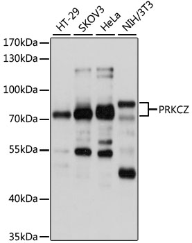 Western blot - PRKCZ Polyclonal Antibody 
