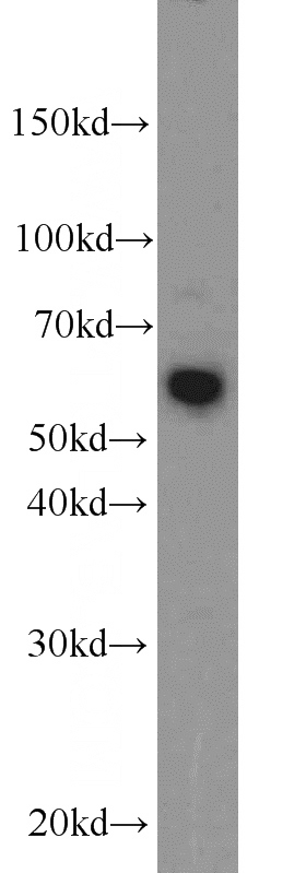 HepG2 cells were subjected to SDS PAGE followed by western blot with Catalog No:112208(LGI3 antibody) at dilution of 1:1000