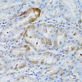 Immunohistochemistry - MOAP1 Polyclonal Antibody 