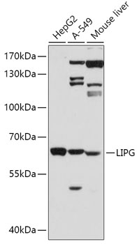 Western blot - LIPG Polyclonal Antibody 