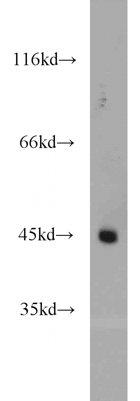 SKOV-3 cells were subjected to SDS PAGE followed by western blot with Catalog No:112299(LPAR4 antibody) at dilution of 1:1000