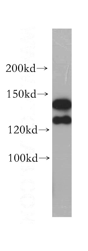 HeLa cells were subjected to SDS PAGE followed by western blot with Catalog No:115533(SPAG5 antibody) at dilution of 1:1000