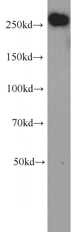 HeLa cells were subjected to SDS PAGE followed by western blot with Catalog No:107732(ACACA antibody) at dilution of 1:500