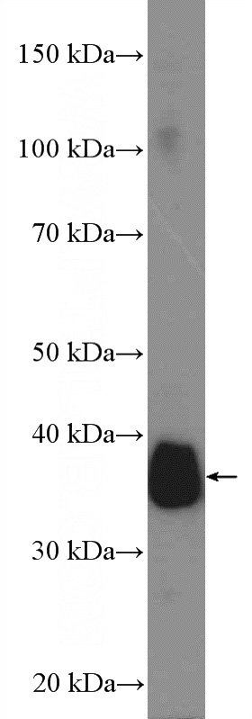 rat liver tissue were subjected to SDS PAGE followed by western blot with Catalog No:113510(OTC Antibody) at dilution of 1:1000