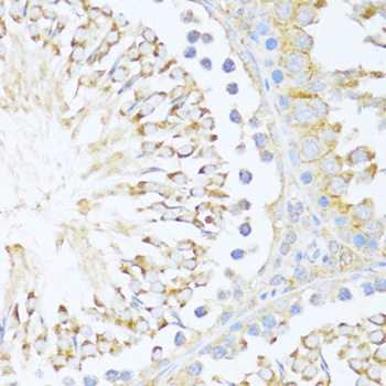 Immunohistochemistry - DDX3Y Polyclonal Antibody 