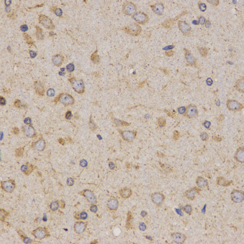 Immunohistochemistry - Eif2ak2 Polyclonal Antibody 