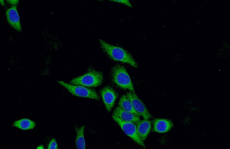 Immunofluorescent analysis of HeLa cells using Catalog No:109405(CLTA Antibody) at dilution of 1:50 and Alexa Fluor 488-congugated AffiniPure Goat Anti-Rabbit IgG(H+L)