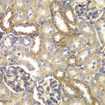 Immunohistochemistry - RAB5C Polyclonal Antibody 