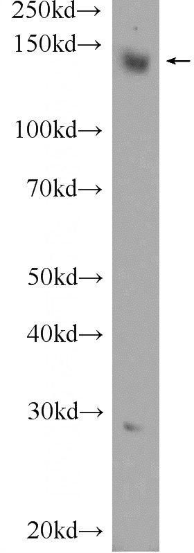 HeLa cells were subjected to SDS PAGE followed by western blot with Catalog No:113514(OTUD4 Antibody) at dilution of 1:1000