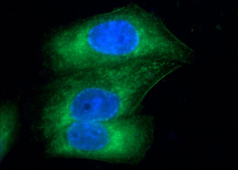 Immunofluorescent analysis of HepG2 cells using Catalog No:108066(ANKRD13A Antibody) at dilution of 1:25 and Alexa Fluor 488-congugated AffiniPure Goat Anti-Rabbit IgG(H+L)