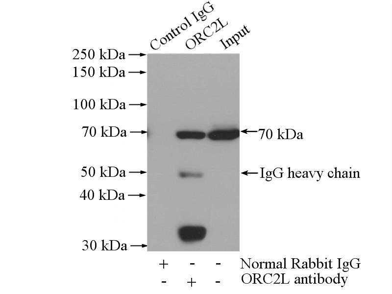 IP Result of anti-ORC2L (IP:Catalog No:113420, 4ug; Detection:Catalog No:113420 1:300) with HepG2 cells lysate 1200ug.