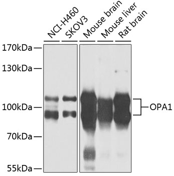 Western blot - OPA1 Polyclonal Antibody 