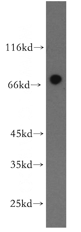 human brain tissue were subjected to SDS PAGE followed by western blot with Catalog No:113317(NPAS1 antibody) at dilution of 1:300