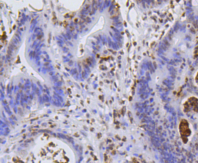Immunohistochemistry - Hydroxyl-Histone H2A-Y39 Monoclonal Antibody 