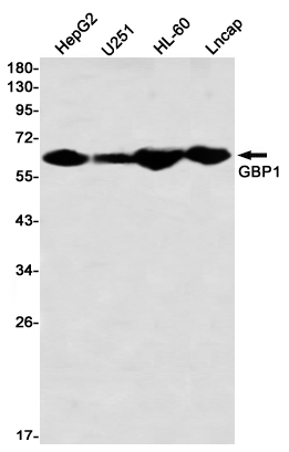 Western blot detection of GBP1 in HepG2,U251,HL-60,Lncap using GBP1 Rabbit mAb(1:1000 diluted)