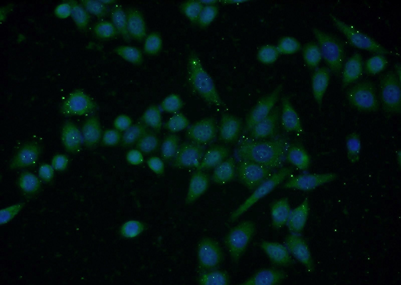 Immunofluorescent analysis of HeLa cells using Catalog No:109917(DHFR Antibody) at dilution of 1:50 and Alexa Fluor 488-congugated AffiniPure Goat Anti-Rabbit IgG(H+L)