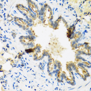 Immunohistochemistry - DEFB4A Polyclonal Antibody 