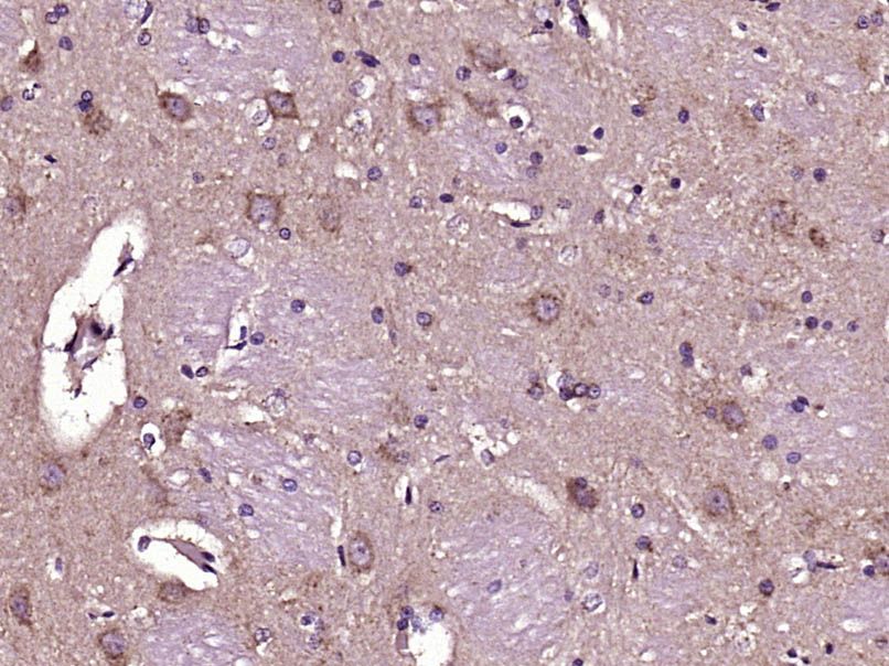 Fig3: Paraformaldehyde-fixed, paraffin embedded (Rat brain); Antigen retrieval by boiling in sodium citrate buffer (pH6.0) for 15min; Block endogenous peroxidase by 3% hydrogen peroxide for 20 minutes; Blocking buffer (normal goat serum) at 37℃ for 30min; Antibody incubation with (COG1) Polyclonal Antibody, Unconjugated at 1:400 overnight at 4℃, followed by operating according to SP Kit(Rabbit) (sp-0023) instructionsand DAB staining.