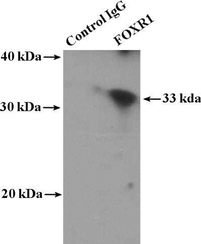 IP Result of anti-FOXR1 (IP:Catalog No:110714, 4ug; Detection:Catalog No:110714 1:500) with mouse brain tissue lysate 4000ug.