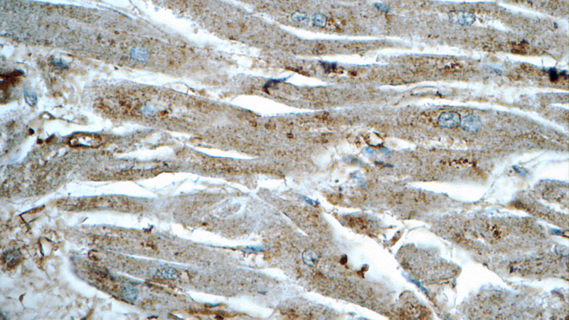 Immunohistochemistry of paraffin-embedded human heart tissue slide using Catalog No:114480(RASIP1 Antibody) at dilution of 1:50 (under 40x lens)