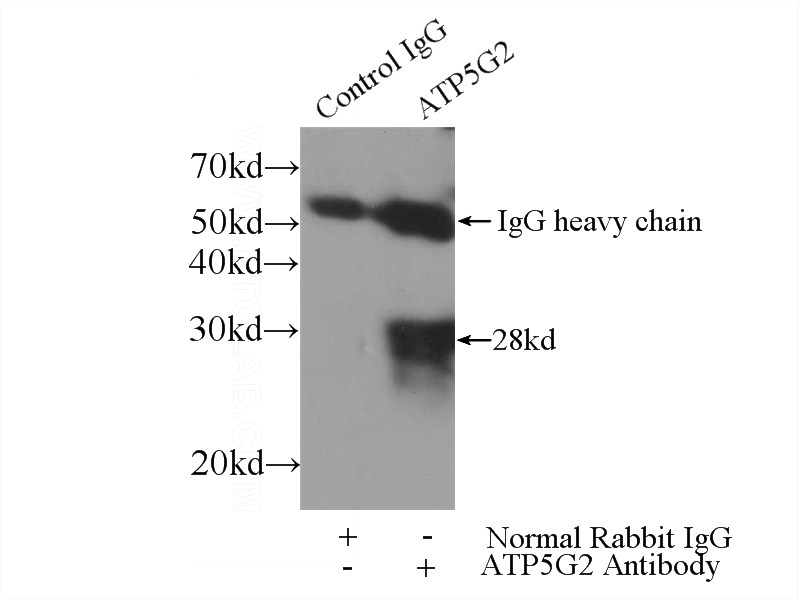 IP Result of anti-ATP5G2-Specific (IP:Catalog No:108354, 3ug; Detection:Catalog No:108354 1:300) with HEK-293 cells lysate 3200ug.