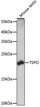 Western blot - TSPO Polyclonal Antibody 