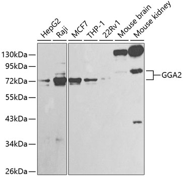 Western blot - GGA2 Polyclonal Antibody 