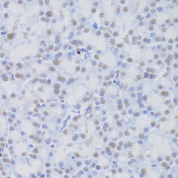Immunohistochemistry - JMJD6 Polyclonal Antibody 