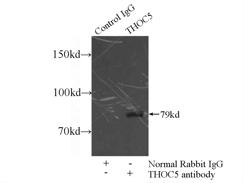 IP Result of anti-THoc5 (IP:Catalog No:116048, 3ug; Detection:Catalog No:116048 1:300) with HEK-293 cells lysate 2000ug.