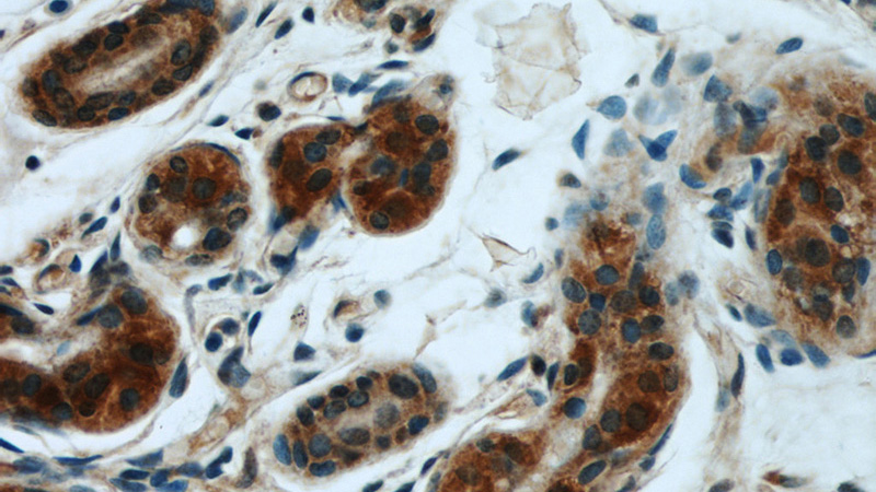 Immunohistochemical of paraffin-embedded human skin using Catalog No:108383(BCAT2 antibody) at dilution of 1:50 (under 40x lens)