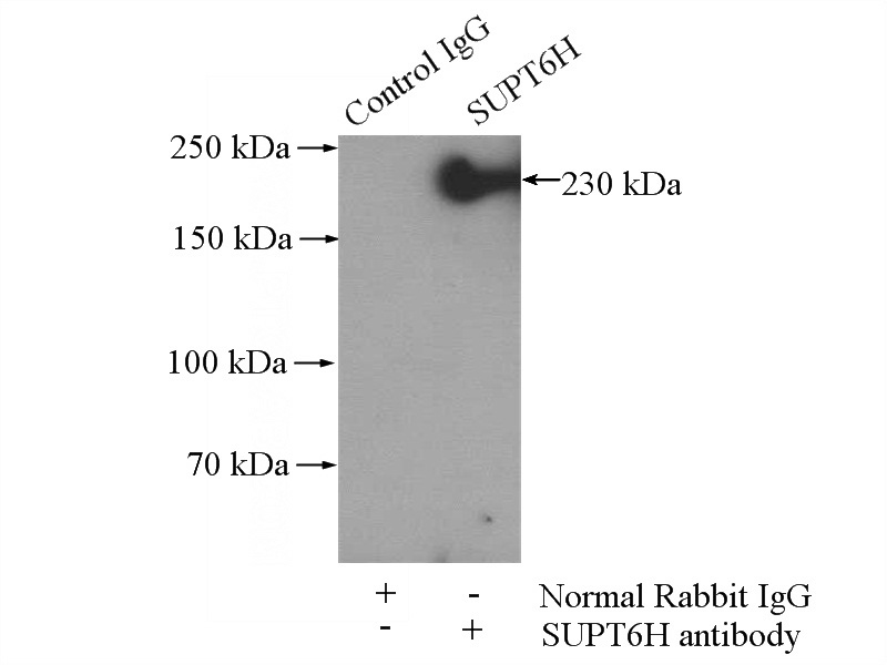IP Result of anti-SUPT6H (IP:Catalog No:115742, 4ug; Detection:Catalog No:115742 1:1000) with HEK-293 cells lysate 1200ug.