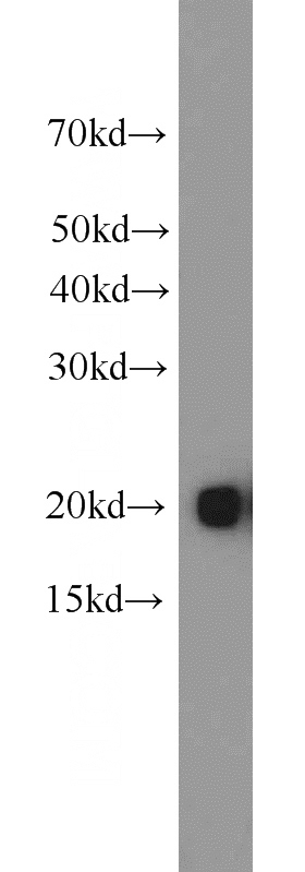 HEK-293 cells were subjected to SDS PAGE followed by western blot with Catalog No:108365(BAX antibody) at dilution of 1:1000