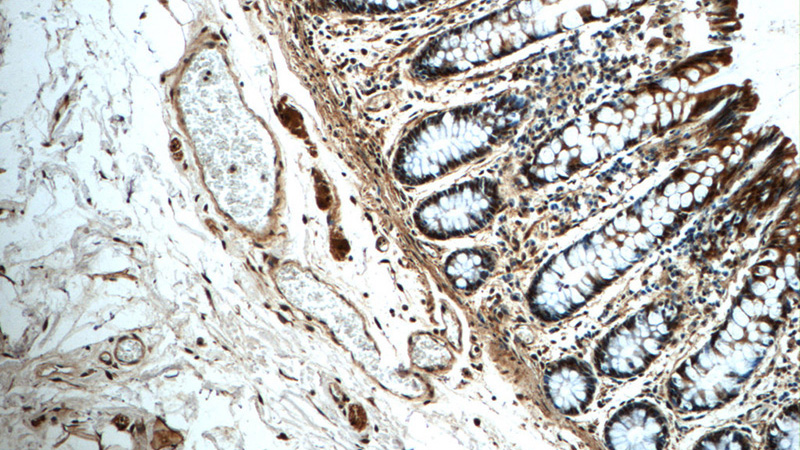 Immunohistochemistry of paraffin-embedded human colon tissue slide using Catalog No:107984(ALKBH1 Antibody) at dilution of 1:50 (under 10x lens)