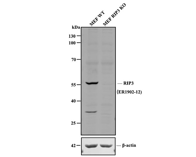 Fig1:; All lanes: Western blot analysis of RIP3 with anti-RIP3 antibody at 1:1,000 dilution.; Lane 1: Wild-type MEF whole cell lysate (20 µg).; Lane 2: RIP3 knockout MEF whole cell lysate (20 µg).; 175161# was shown to specifically react with RIP3 in wild-type MEF cells. No band was observed when RIP3 knockout sample was tested. Wild-type and RIP3 knockout samples were subjected to SDS-PAGE. Proteins were transferred to a PVDF membrane and blocked with 5% NFDM in TBST for 1 hour at room temperature. The primary antibody ( 1/1,000) and Loading control antibody (Rabbit anti-β-actin, R1207-1, 1/1,000) was used in 5% BSA at room temperature for 2 hours. Goat Anti-Rabbit IgG-HRP Secondary Antibody (HA1001) at 1:200,000 dilution was used for 1 hour at room temperature.