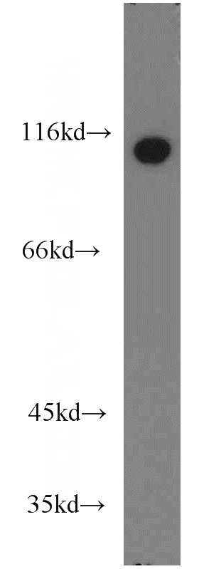 HeLa cells were subjected to SDS PAGE followed by western blot with Catalog No:110019(DBN1 antibody) at dilution of 1:1500