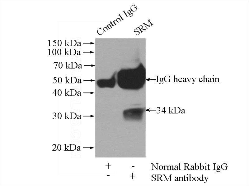 IP Result of anti-SRM (IP:Catalog No:115562, 4ug; Detection:Catalog No:115562 1:500) with mouse liver tissue lysate 4000ug.