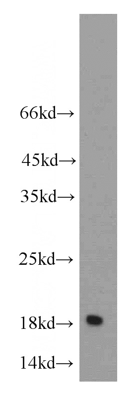 mouse kidney tissue were subjected to SDS PAGE followed by western blot with Catalog No:113248(NME3 antibody) at dilution of 1:300