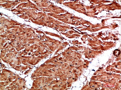 Fig1:; Immunohistochemical analysis of paraffin-embedded human-heart, antibody was diluted at 1:200