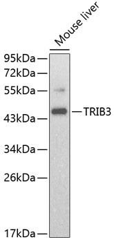 Western blot - TRIB3 Polyclonal Antibody 