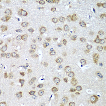 Immunohistochemistry - EIF1AX Polyclonal Antibody 