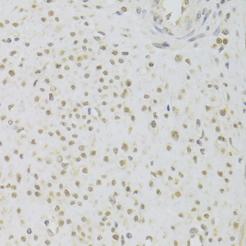 Immunohistochemistry - PRPF3 Polyclonal Antibody 