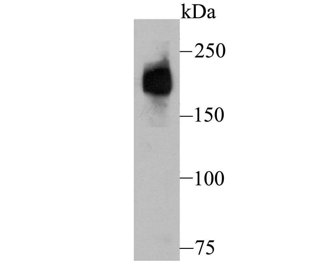 Fig1: Western blot analysis of Dysferlin on human fetal skeletal muscle tissue lysate using anti-Dysferlin antibody at 1/500 dilution.