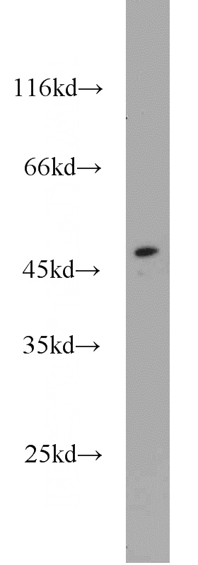 HeLa cells were subjected to SDS PAGE followed by western blot with Catalog No:115487(SOAT2 antibody) at dilution of 1:1000