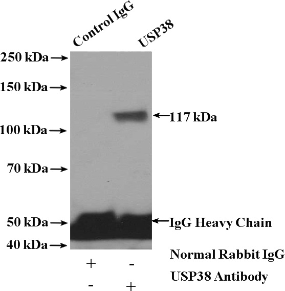 IP Result of anti-USP38 (IP:Catalog No:116680, 4ug; Detection:Catalog No:116680 1:500) with K-562 cells lysate 3200ug.