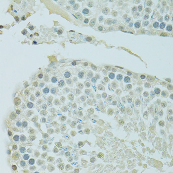 Immunohistochemistry - BRD3 Polyclonal Antibody 