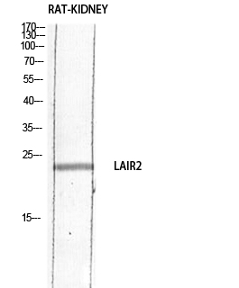 Fig1:; Western blot analysis of RAT-KIDNEY lysis using LAIR2 antibody. Antibody was diluted at 1:1000. Secondary antibody（catalog#: HA1001) was diluted at 1:20000